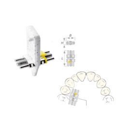 Dehnschraube Vector 140 medium 50St Dehnschraube Vector 140 medium 50St