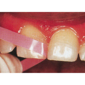 Super-Snap Mandrell FG 6St Super-Snap Mandrell FG 6St