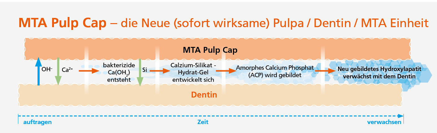 Cumdente MTA PulpCap | 410067