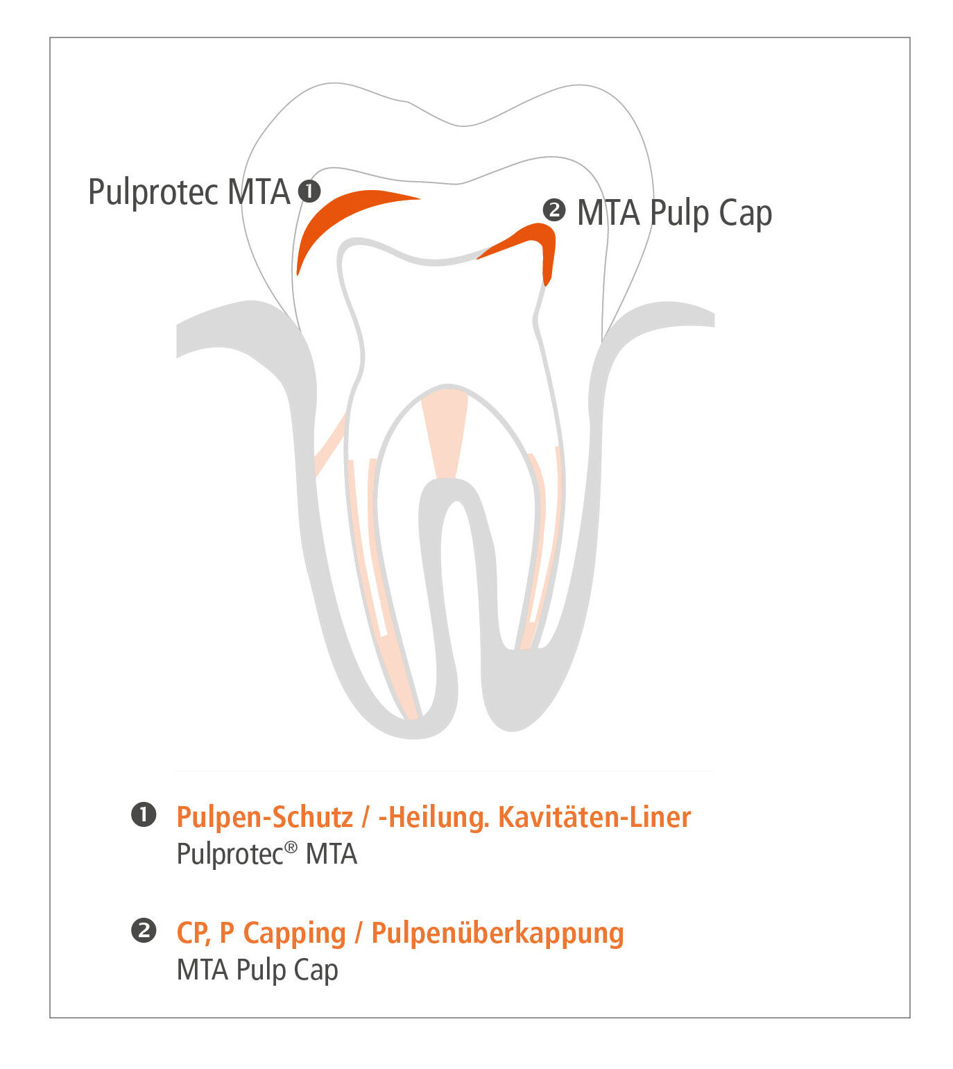 Cumdente MTA PulpCap | 410069