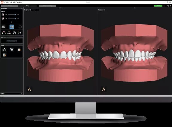 DEXIS™ IS Ortho | 322743
