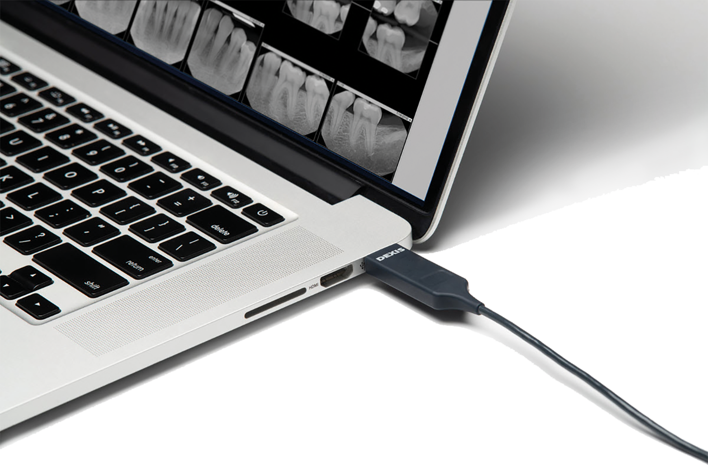 DEXIS® Titanium PerfectSize™ Röntgensensor | 325430 DEXIS® Titanium PerfectSize™ Röntgensensor | 325430
