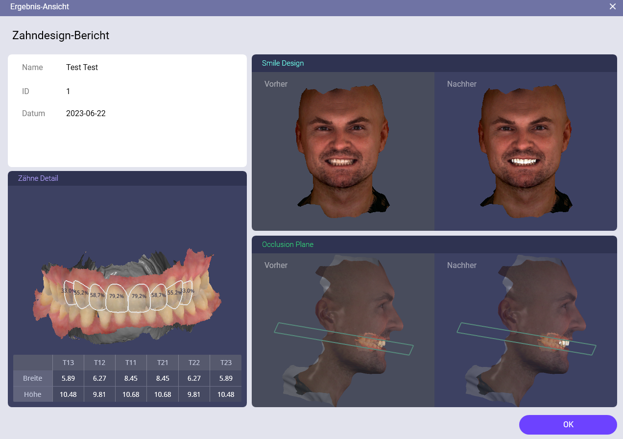 RayFace 200 | 325449 RayFace 200 | 325449
