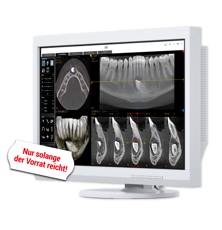 EIZO Befundungsmonitor MX232W-DT | 325442 EIZO Befundungsmonitor MX232W-DT | 325442