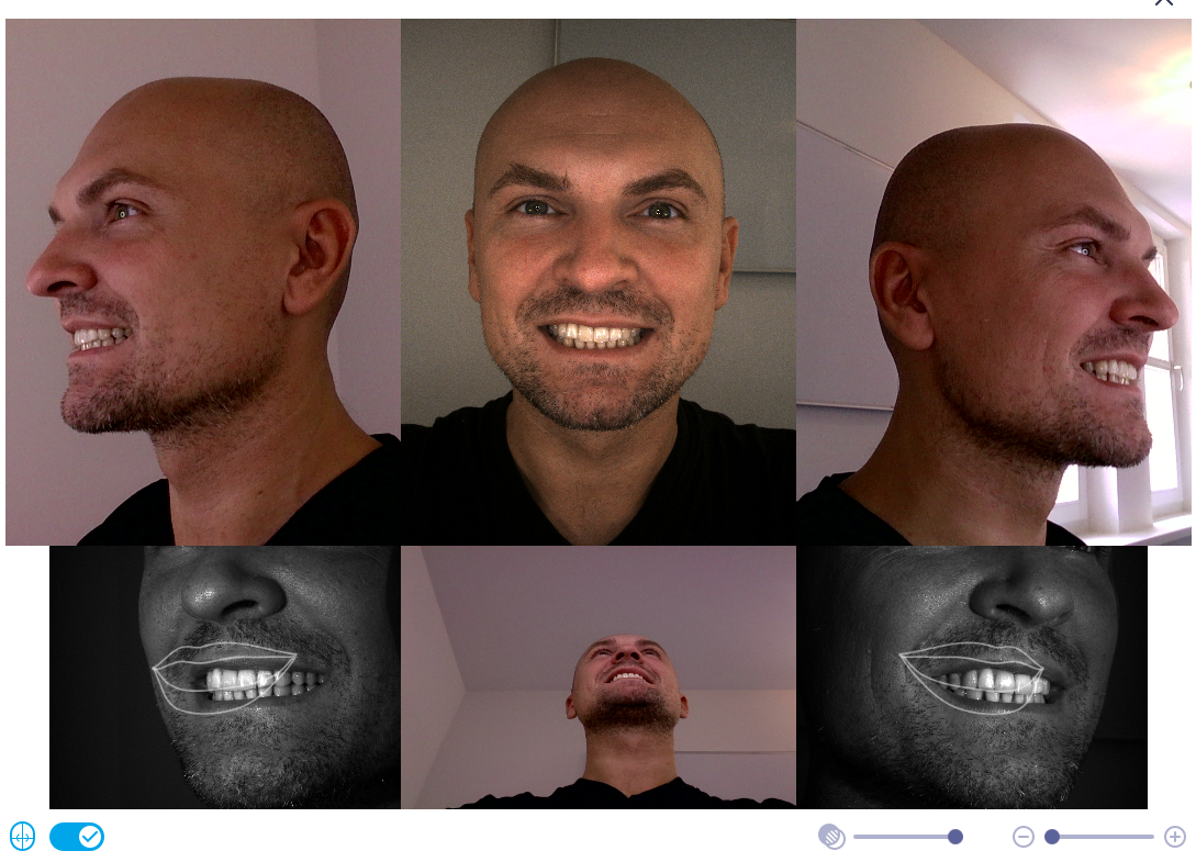 RayFace 200 | 325450 RayFace 200 | 325450