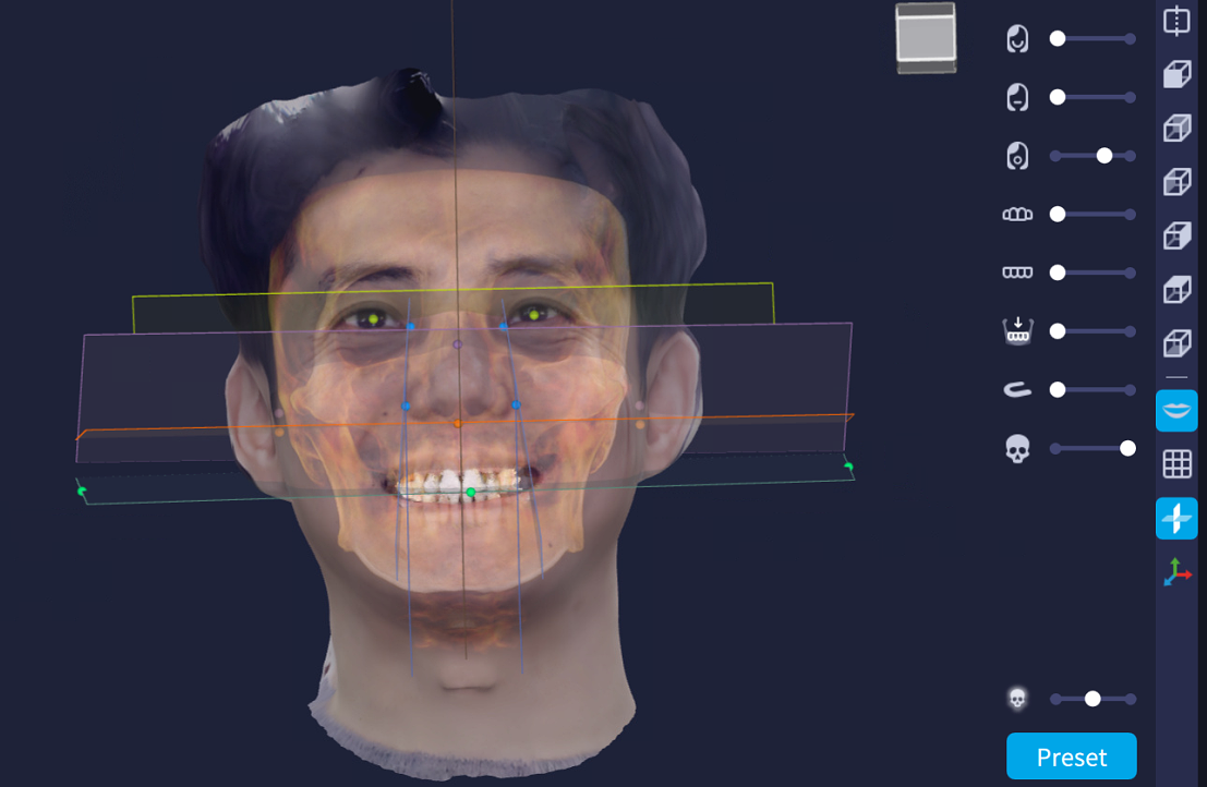 SCANvolution Roadshow – das 5D-Konzept für Zahnmedizin & KFO | 327728 SCANvolution Roadshow – das 5D-Konzept für Zahnmedizin & KFO | 327728