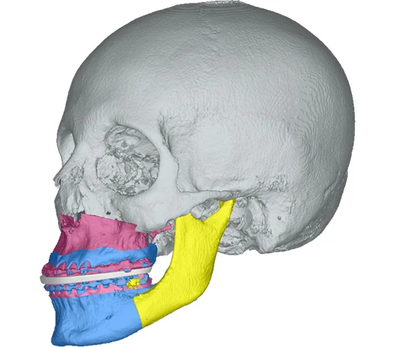 Planmeca ProMax 3D Classic Ceph DVT+OPG Bj. 2020 inkl. Installation und Montage | 325796 Planmeca ProMax 3D Classic Ceph DVT+OPG Bj. 2020 inkl. Installation und Montage | 325796