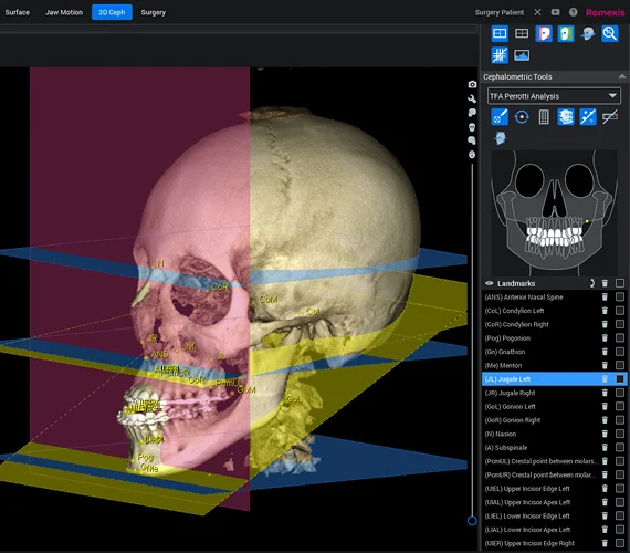 Planmeca ProMax 3D Classic Ceph DVT+OPG Bj. 2020 inkl. Installation und Montage | 325797 Planmeca ProMax 3D Classic Ceph DVT+OPG Bj. 2020 inkl. Installation und Montage | 325797