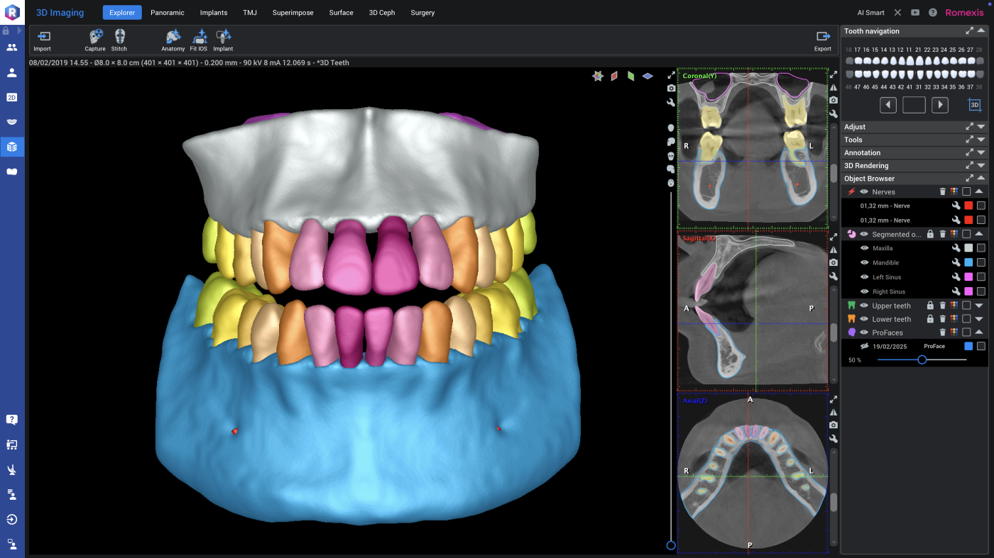KaVo Romexis | All-in-One Software für Klinik und Praxis | 328697 KaVo Romexis | All-in-One Software für Klinik und Praxis | 328697