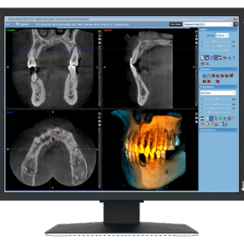 EIZO MX217-HB Befundungsmonitor Dental EIZO MX217-HB Befundungsmonitor Dental