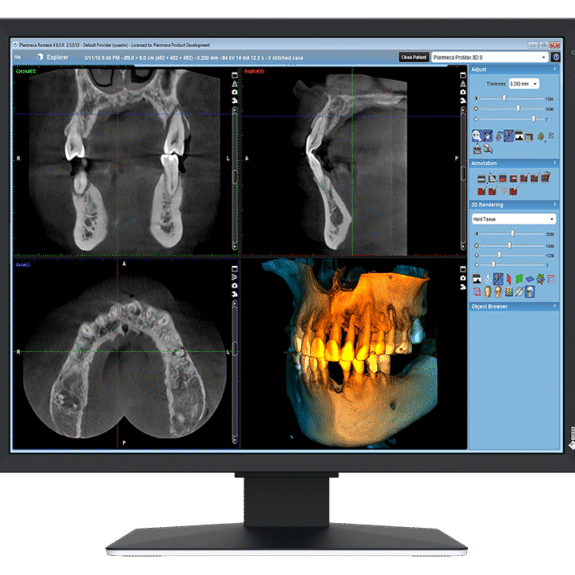 EIZO MX217-HB Befundungsmonitor Dental | 331697