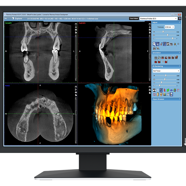 EIZO MX217-HB Befundungsmonitor Dental | 331697 EIZO MX217-HB Befundungsmonitor Dental | 331697