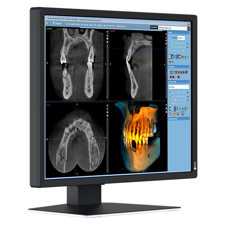 EIZO MX217-HB Befundungsmonitor Dental | 331698 EIZO MX217-HB Befundungsmonitor Dental | 331698