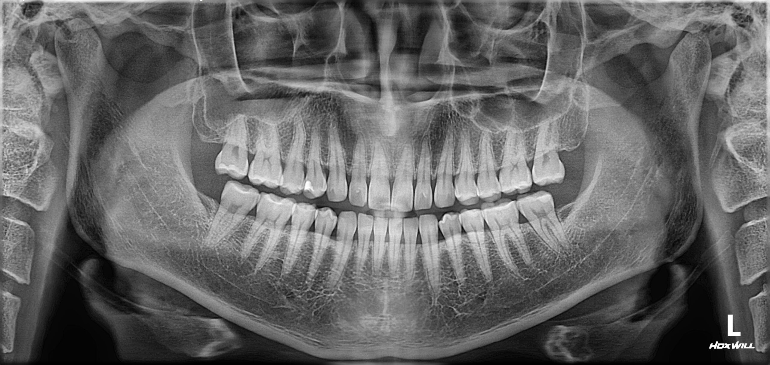 HDX WILL ECO-X DVT / XRAYdental Jubiläumsangebot | 334332 HDX WILL ECO-X DVT / XRAYdental Jubiläumsangebot | 334332