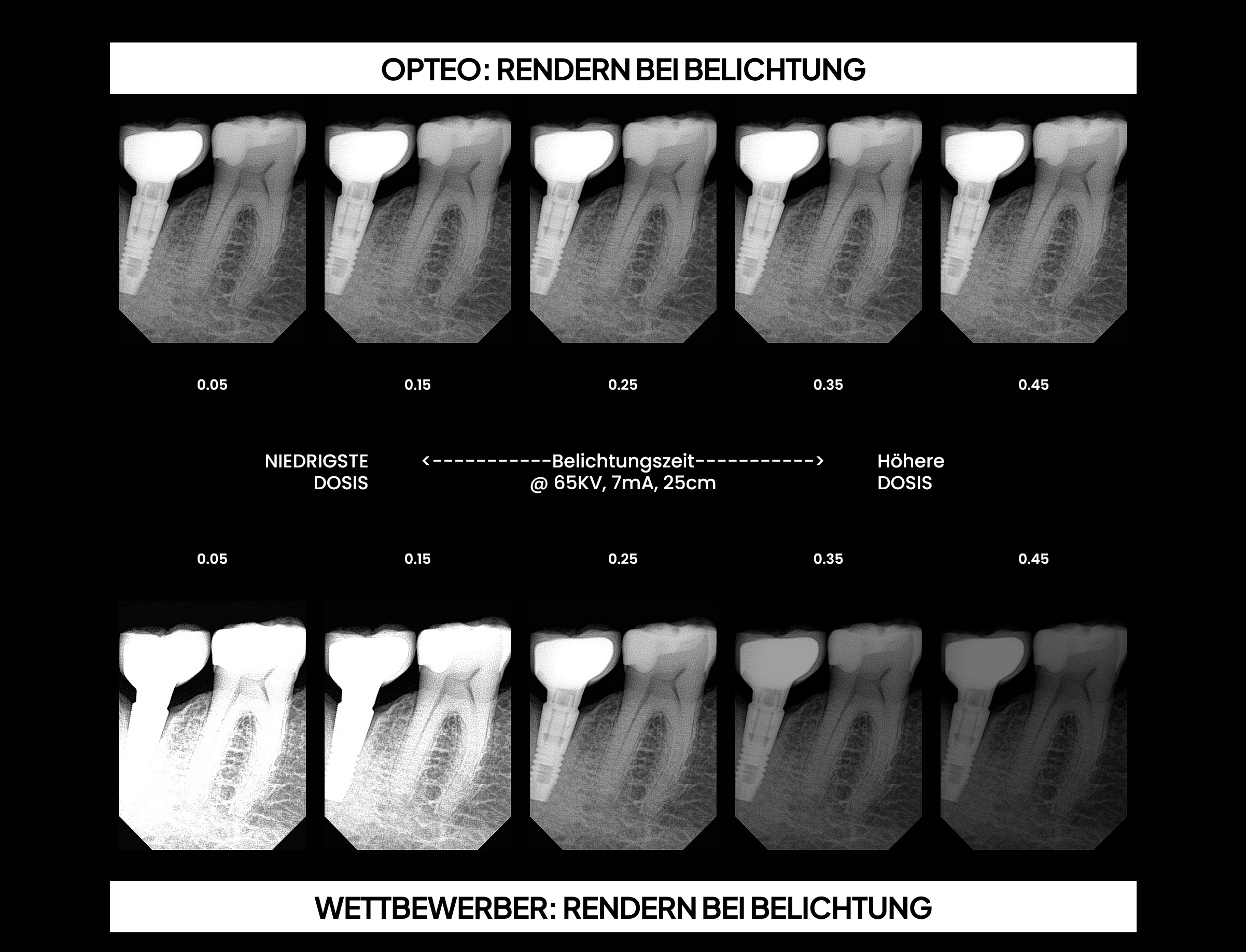 Owandy Opteo Digitaler Röntgensensor  von Größe #1 22 x 30  oder #1.5 24 x 33 mm oder #2 26 x 35 über Twain für Sidexis, Dürr,  Kavo Cliniview DTX  usw | 333860