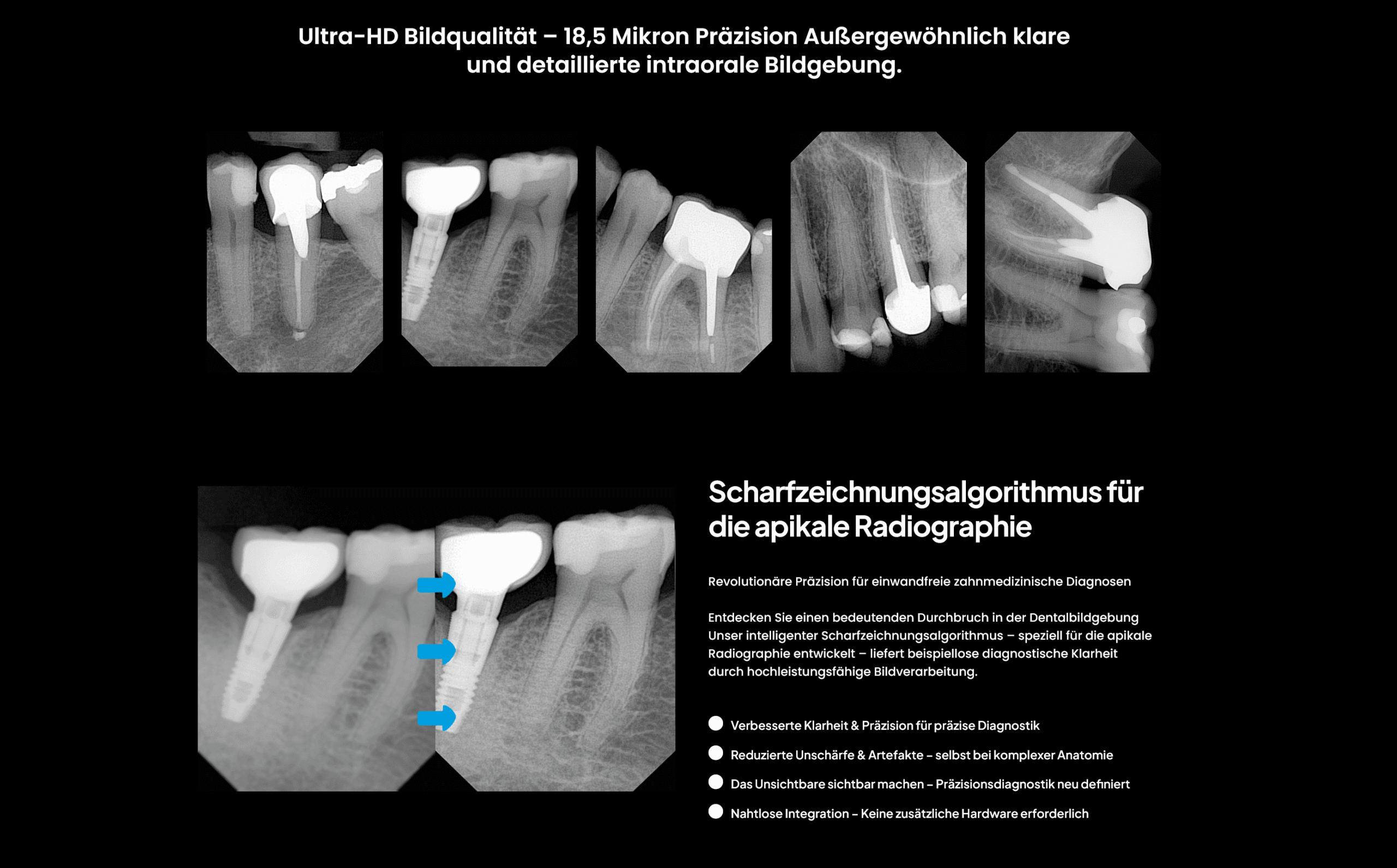 Owandy Opteo Digitaler Röntgensensor  von Größe #1 22 x 30  oder #1.5 24 x 33 mm oder #2 26 x 35 über Twain für Sidexis, Dürr,  Kavo Cliniview DTX  usw | 333854