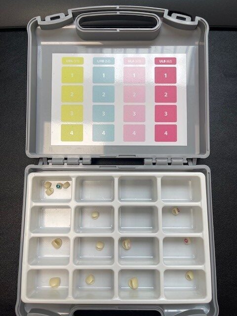 Kiddy Caps Starter Kit inkl. Incisor Upper Kit + Canine Kit | 333793 Kiddy Caps Starter Kit inkl. Incisor Upper Kit + Canine Kit | 333793