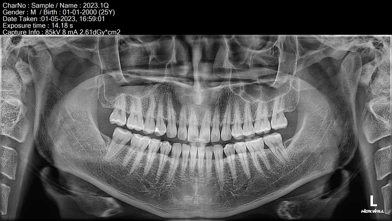 HDX WILL ECO-X DVT BASIC / XRAYdental Jubiläumsangebot | 334577