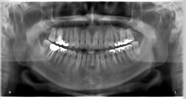 Morita IC 5 HD Bj. 2014 / sehr gepflegt / 1J. Gewährleistung | 334612