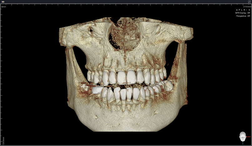 HDX WILL ECO-X DVT BASIC / XRAYdental Jubiläumsangebot | 334578