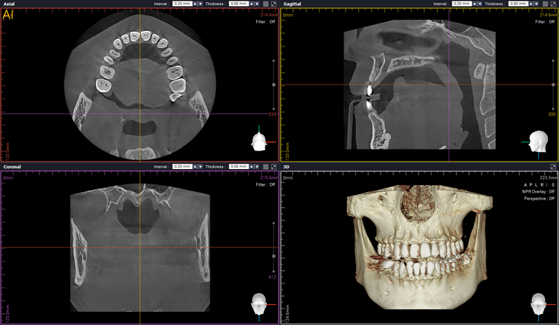 HDX WILL ECO-X DVT BASIC / XRAYdental Jubiläumsangebot | 334579
