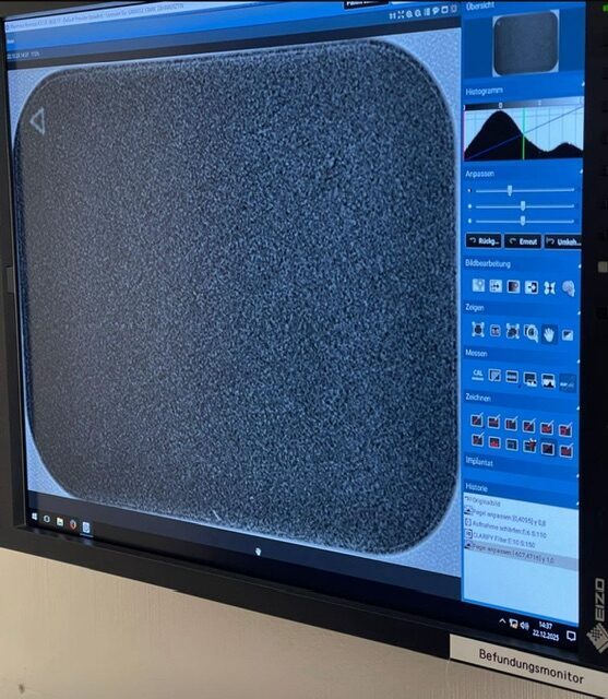 Planmeca ProScanner 2.0 Intra Speicherfolienscanner | 337714