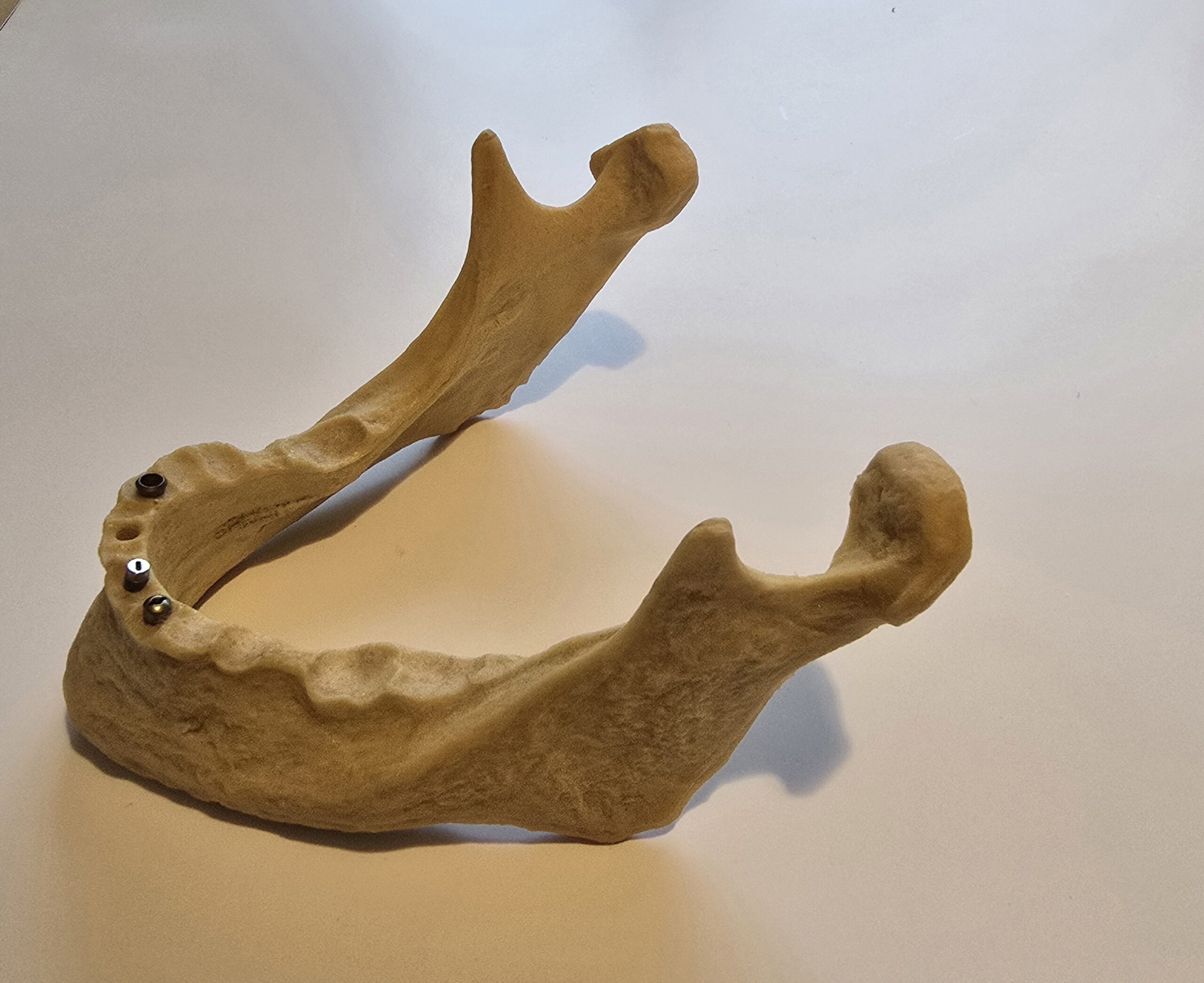 Übungskiefer Demonstrationsmodell Implantate | 338006