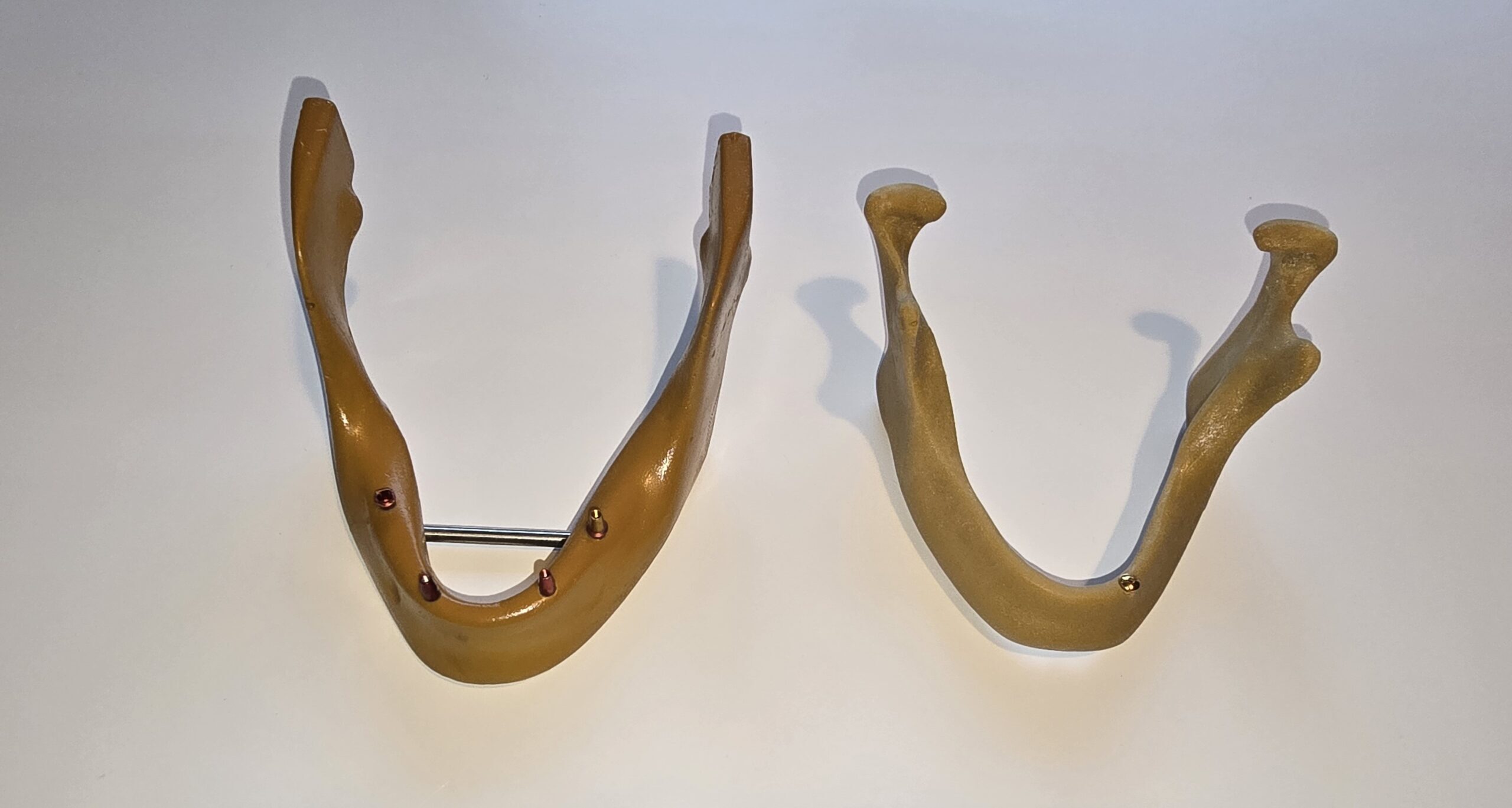 2 Stück Übungskiefer Demonstrationsmodell Implantate | 338010
