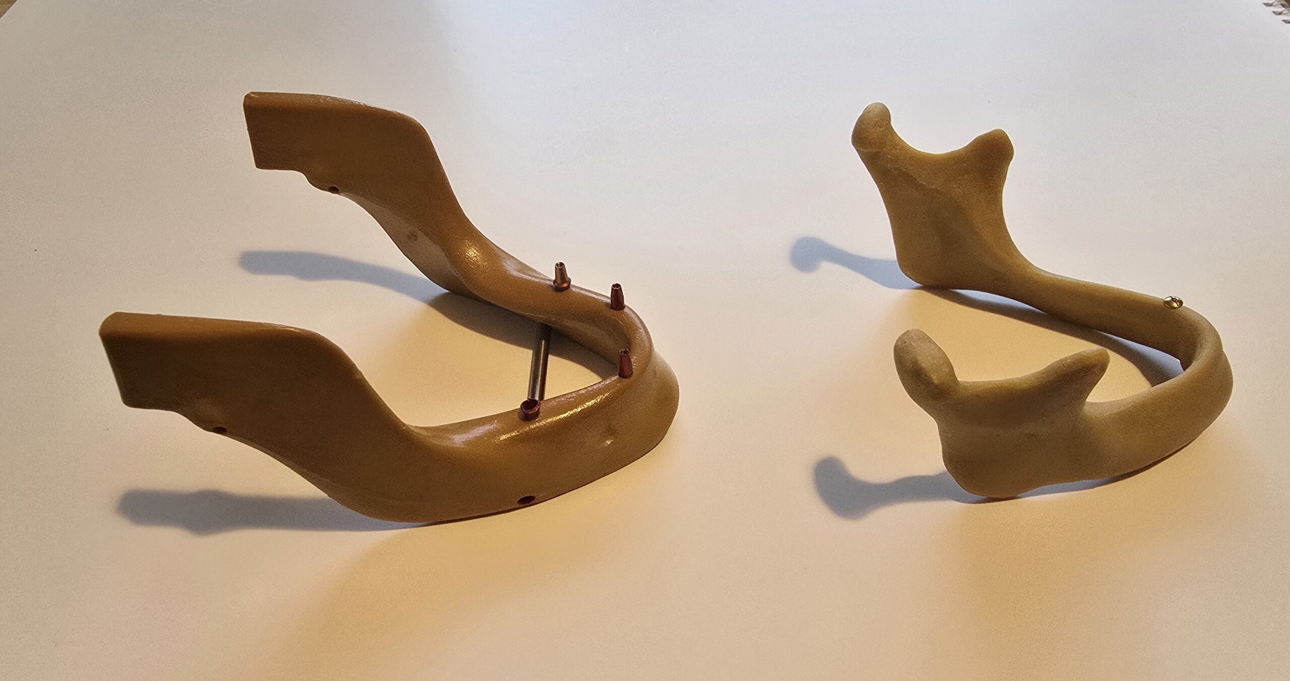 2 Stück Übungskiefer Demonstrationsmodell Implantate | 338011