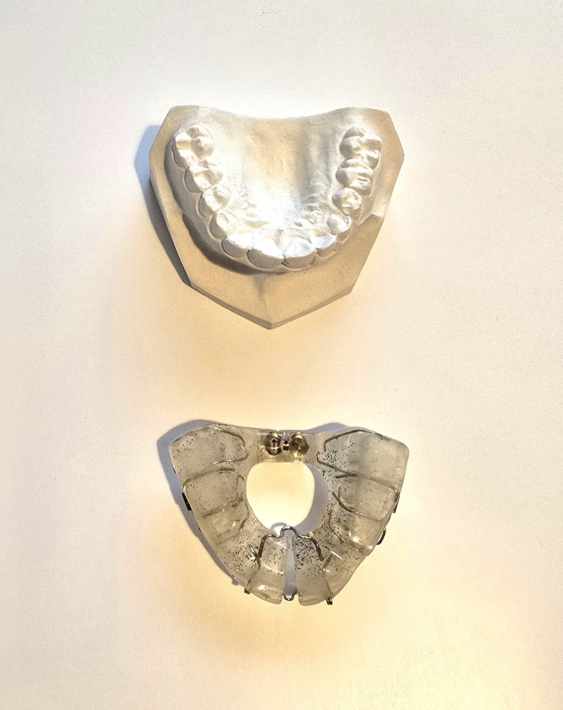 Demonstrationsmodell Kieferorthopädie OK Dehnplatte NEU | 338738