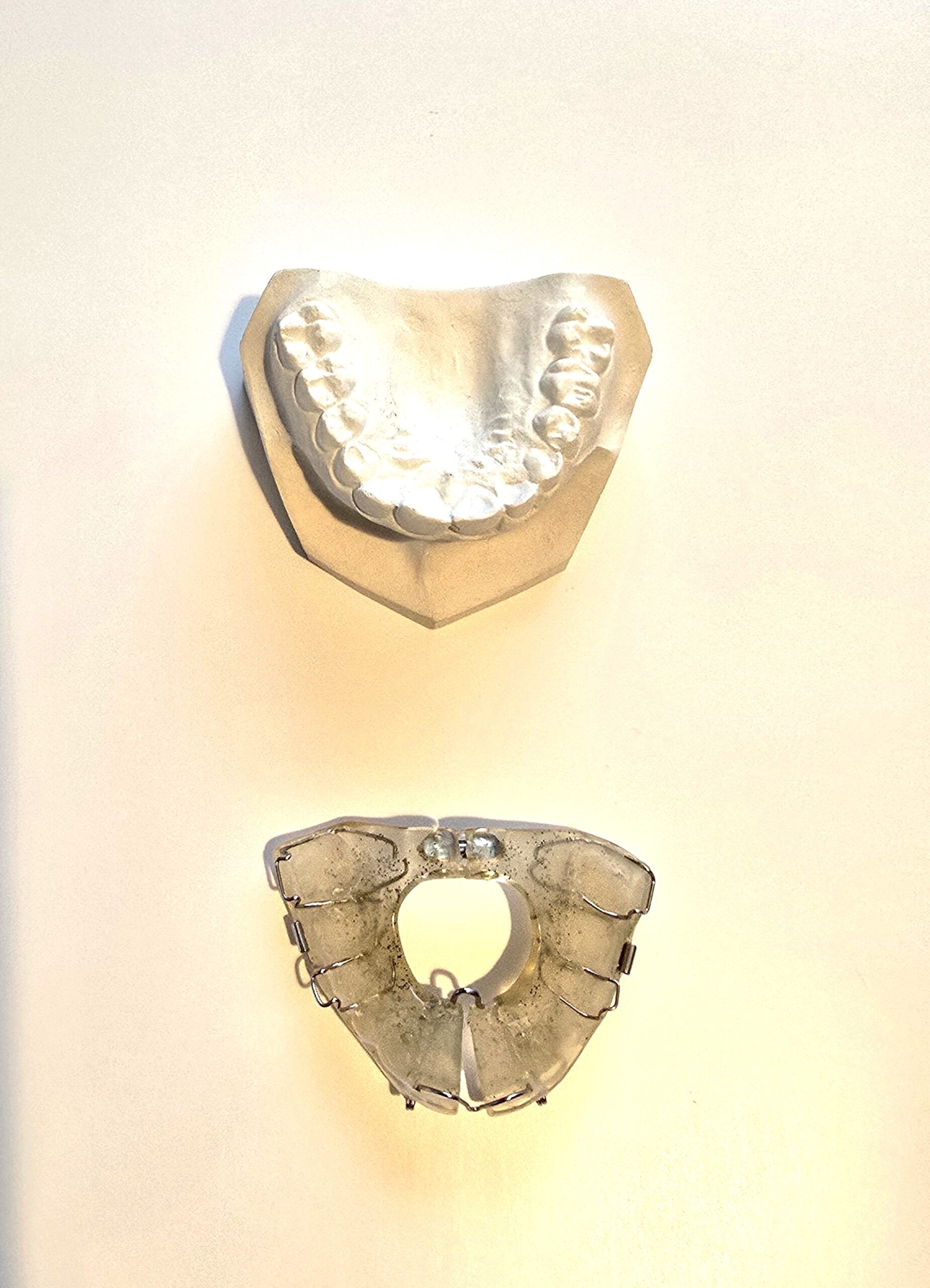 Demonstrationsmodell Kieferorthopädie OK Dehnplatte NEU | 338741