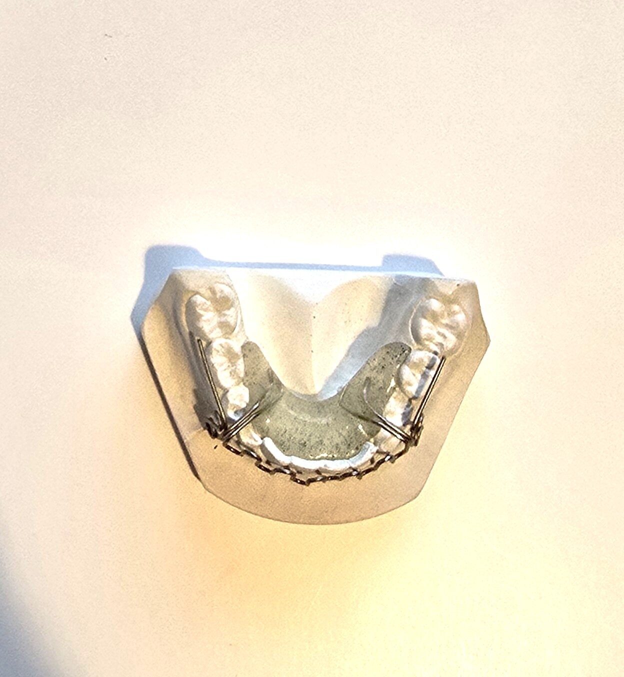 Demonstrationsmodell Kieferorthopädie UK NEU | 338745