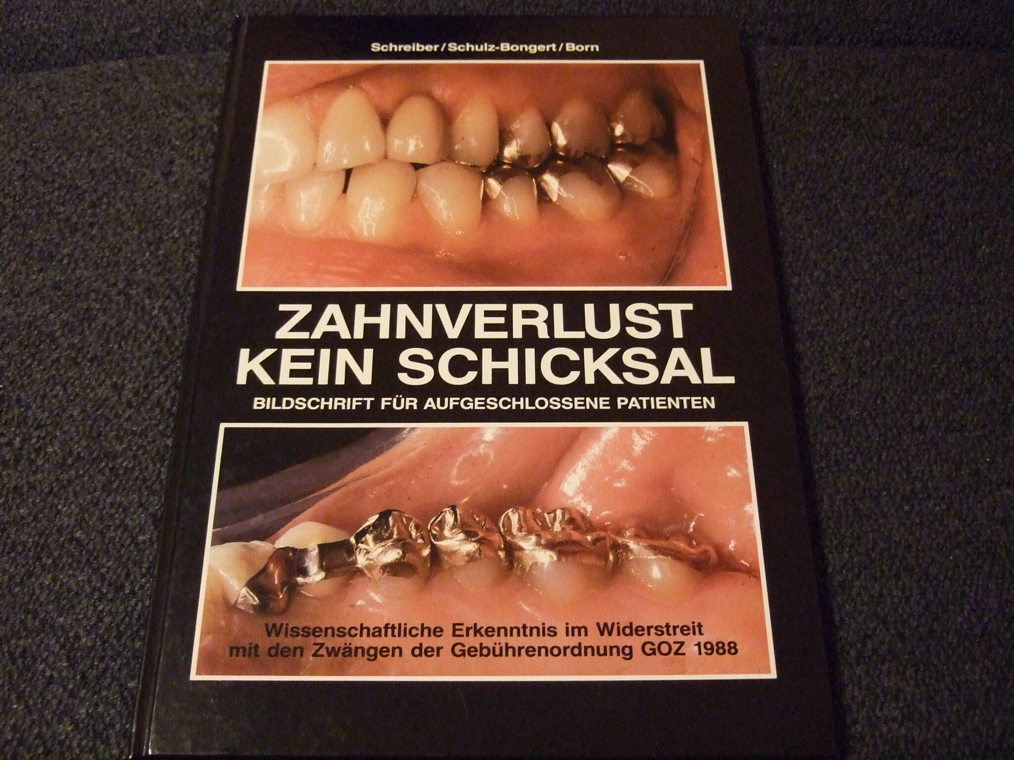 Zahnverlust – kein Schicksal von Dr. Joachim Schulz-Bongert | 338072