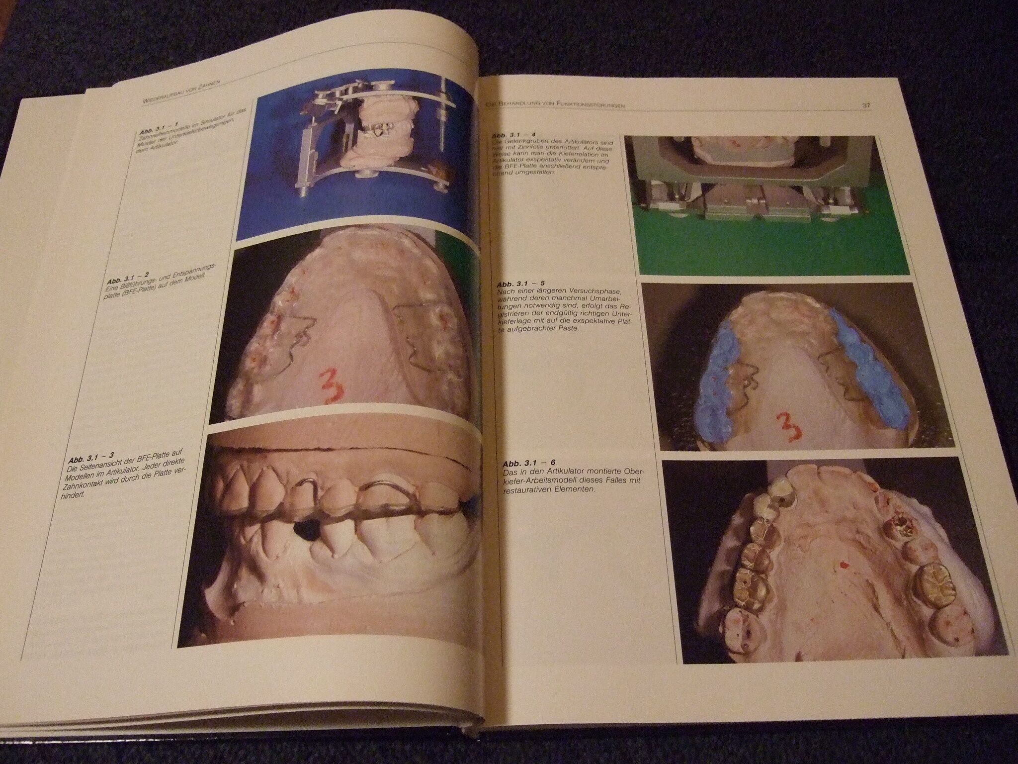 Zahnverlust – kein Schicksal von Dr. Joachim Schulz-Bongert | 338074