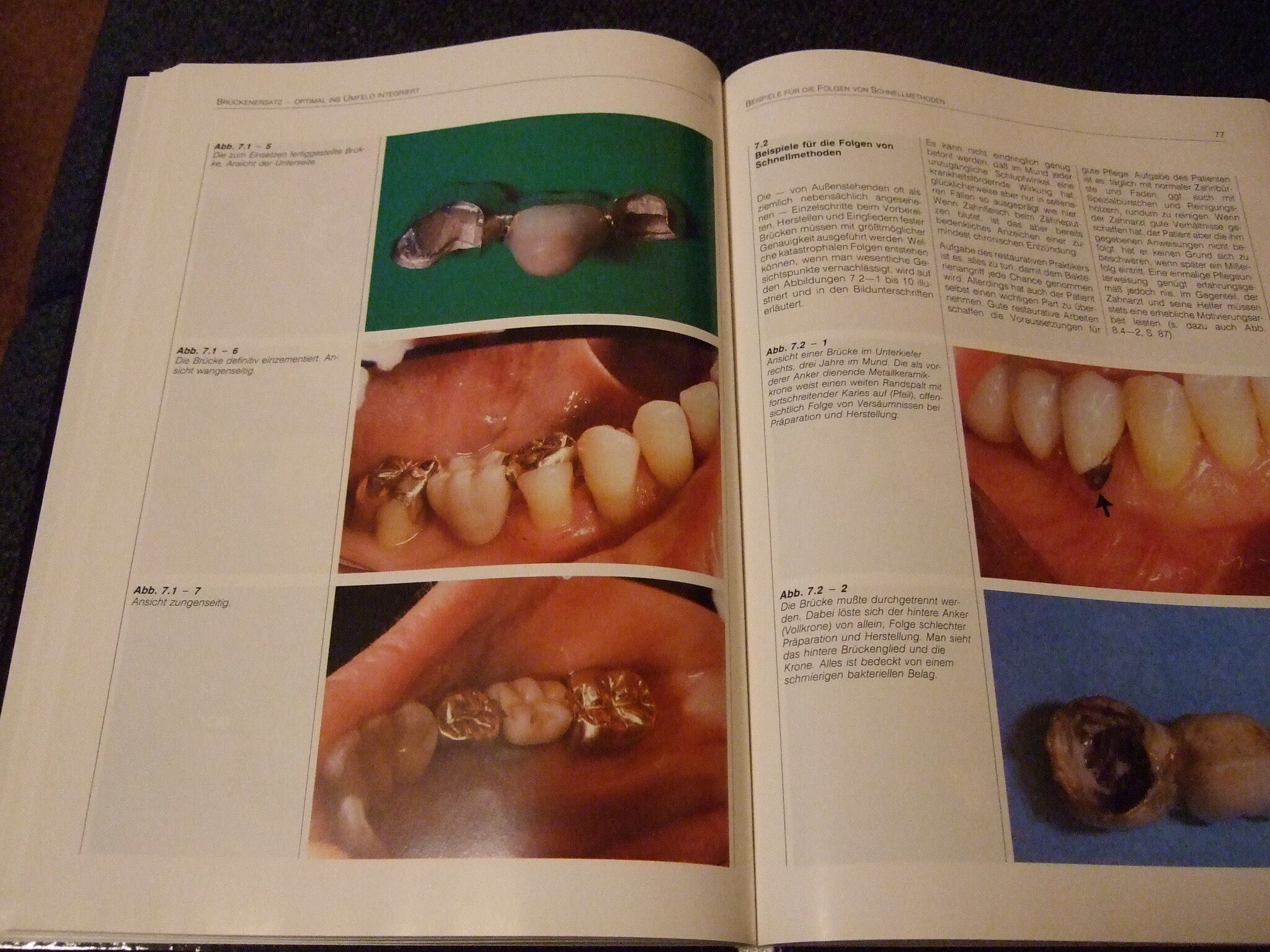 Zahnverlust – kein Schicksal von Dr. Joachim Schulz-Bongert | 338075