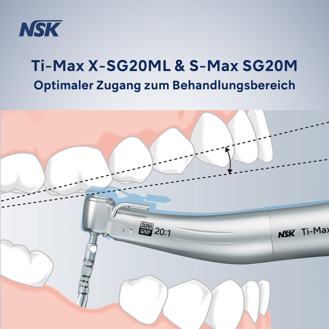 Chirurgie-Winkelstücke mit Mini-Kopf Ti-Max X-SG20ML und S-Max SG20M | 342237