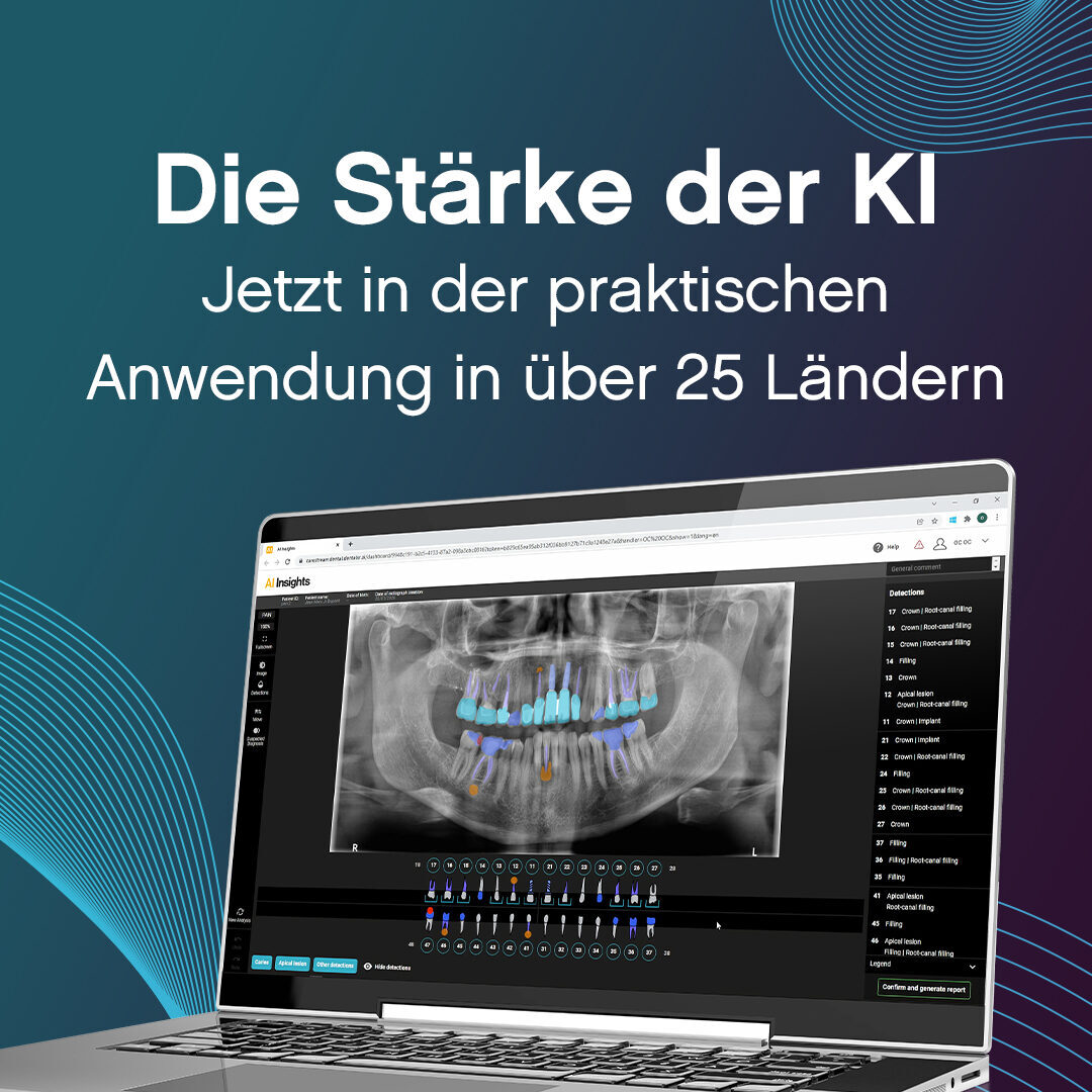 Carestream KI-Software für automatisierte Diagnostik – „AI Insights“ | 342739
