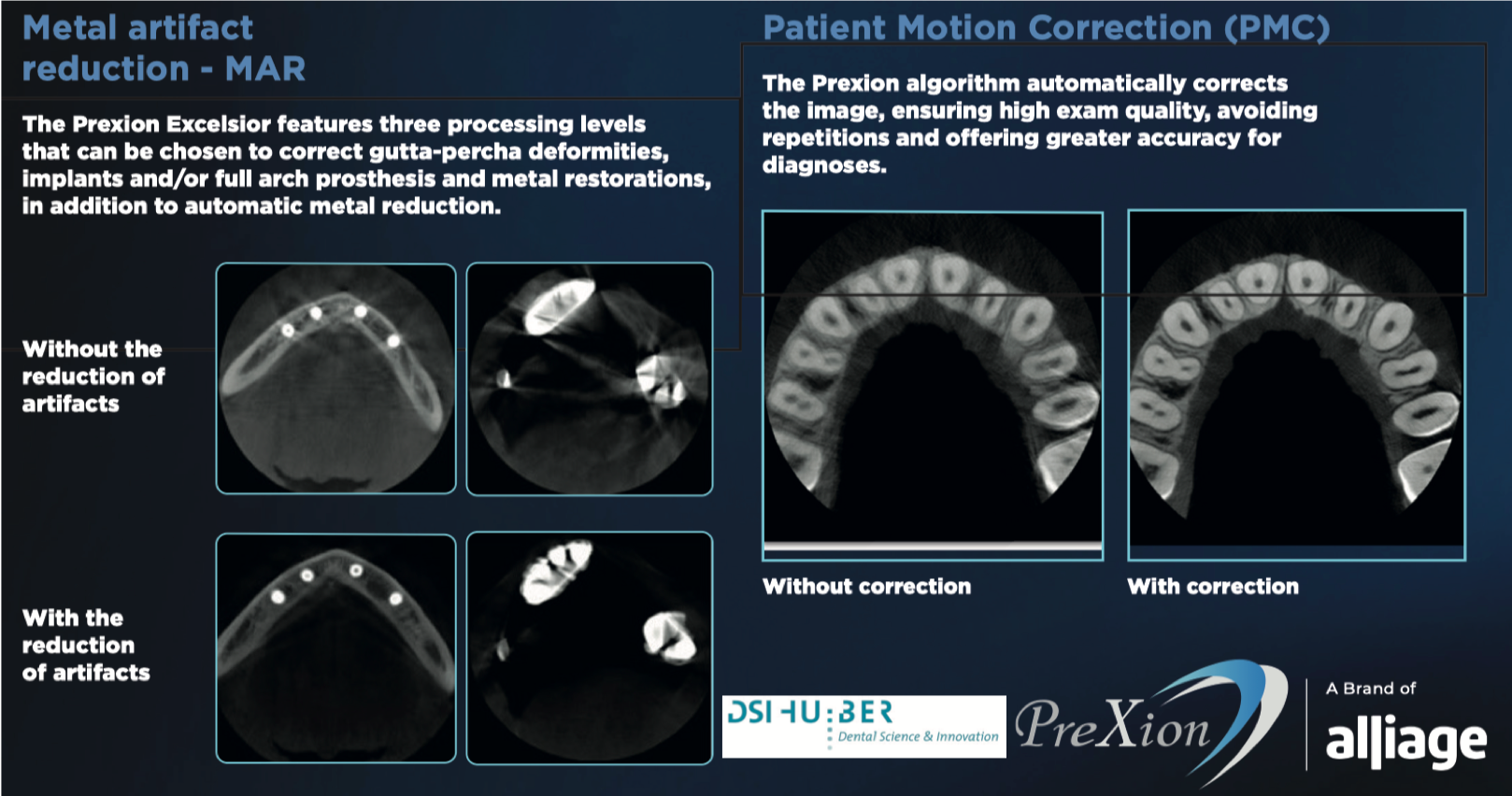 NEU! Prexion Excelsior DVT, Volumen 5x5cm – 16x9cm, 5 Jahre Garantie. Inkl. Prüfkörper, PC, OnDemand Software. | 342854
