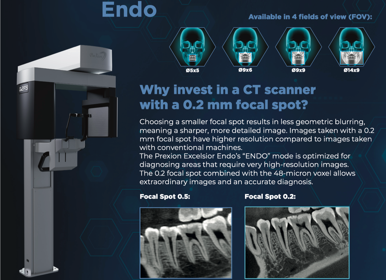 NEU! Prexion Excelsior DVT, Volumen 5x5cm – 16x9cm, 5 Jahre Garantie. Inkl. Prüfkörper, PC, OnDemand Software. | 342853