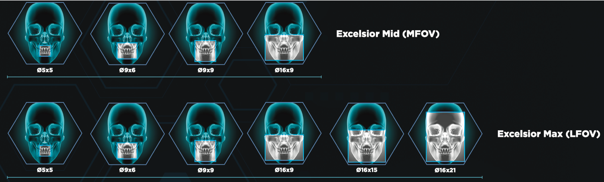 NEU! Prexion Excelsior DVT, Volumen 5x5cm – 16x9cm, 5 Jahre Garantie. Inkl. Prüfkörper, PC, OnDemand Software. | 342852