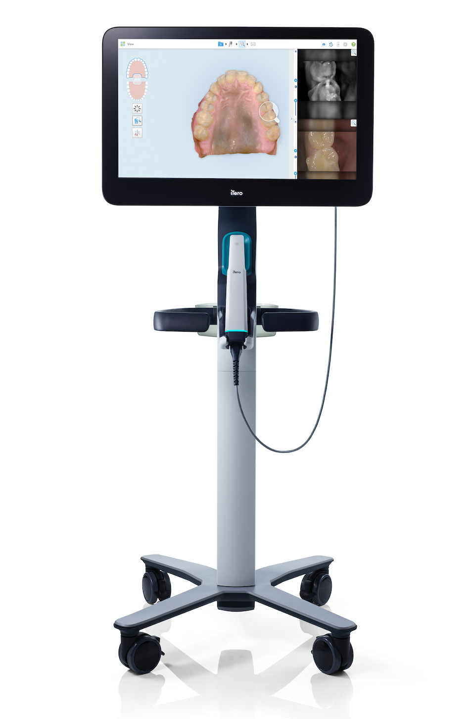 Neuwertiger Intraoralscanner Itero Lumina zu verkaufen – Top-Zustand, Cart-Version (Baujahr 2022) | 345624