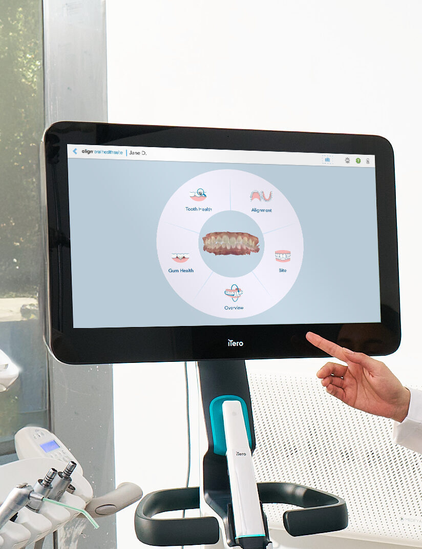 Neuwertiger Intraoralscanner Itero Lumina zu verkaufen – Top-Zustand, Cart-Version (Baujahr 2022) | 345623