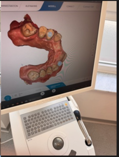 SIRONA Omnicam | 354968