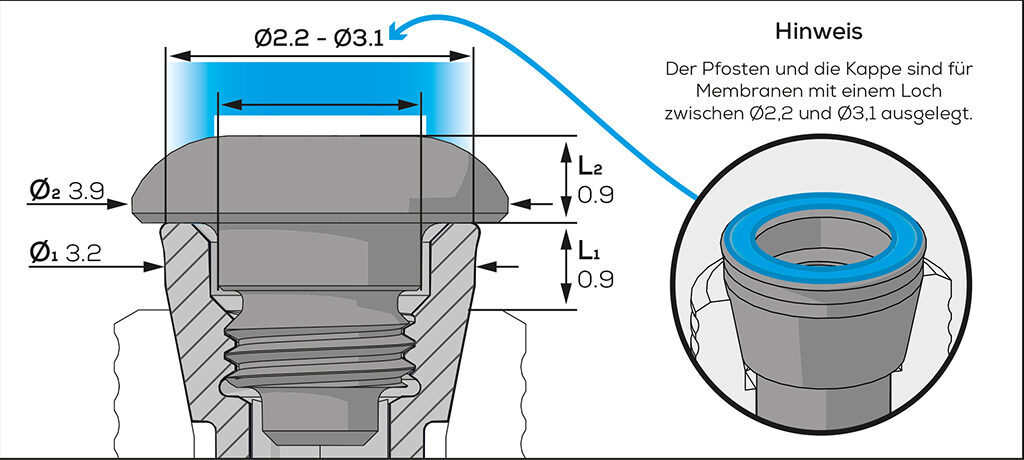 ICX-Membranschraube | 377245