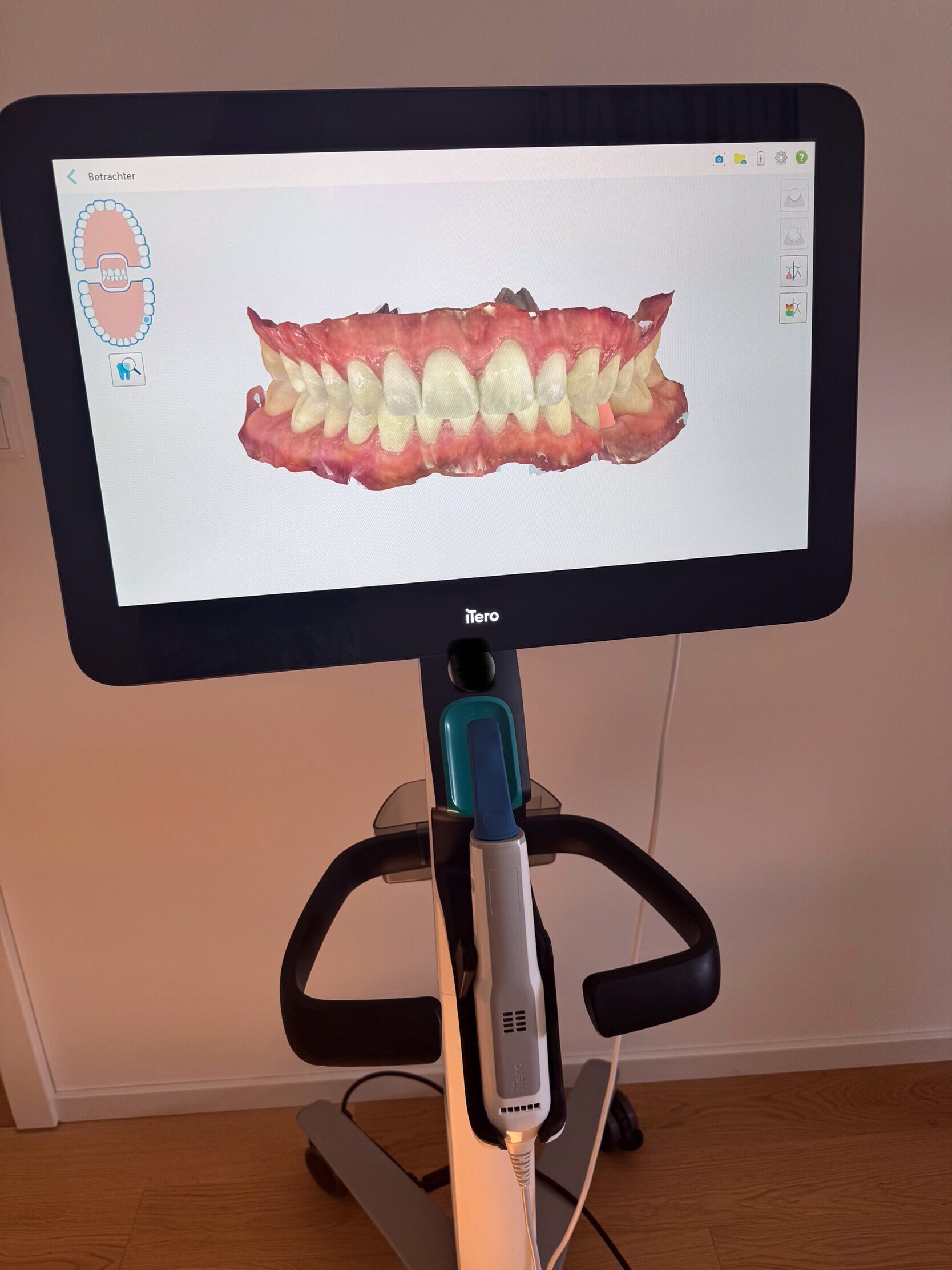 Itero Element 5D Plus  Intraoralscanner | 376590