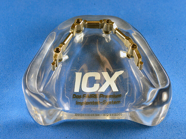 Plexiglas Modell mit Restauration | 377904