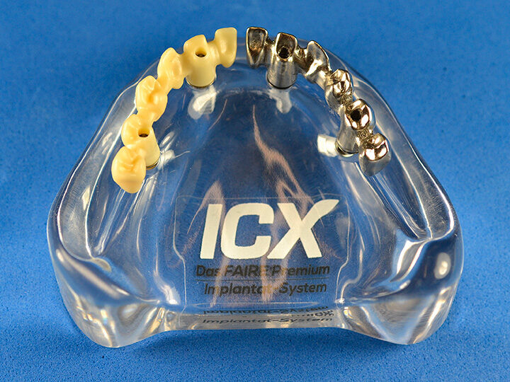 Plexiglas Modell mit Restauration | 377914