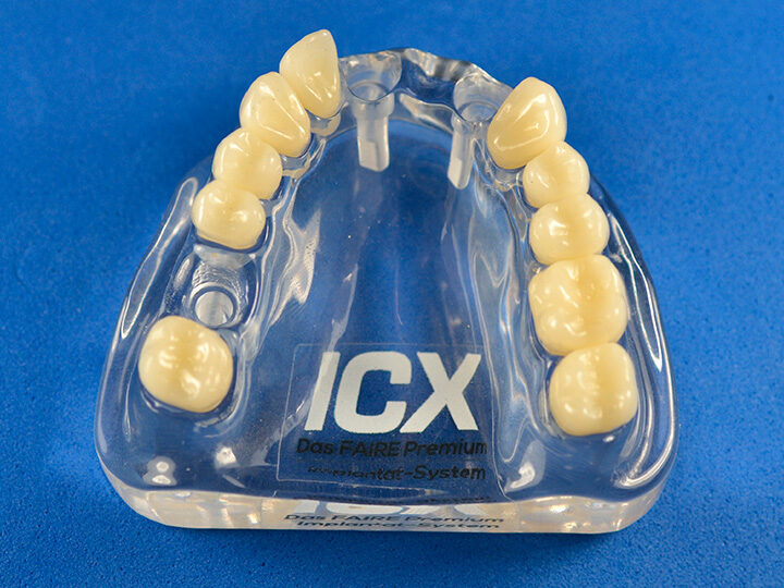 Plexiglas Modell ohne ICX-Modellanaloge | 377906