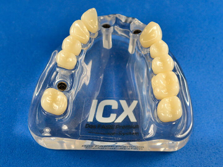 Plexiglas Modell mit ICX Modellanalogen | 377908