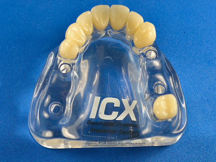 Plexiglas Modell ohne ICX Modellanaloge | 377910
